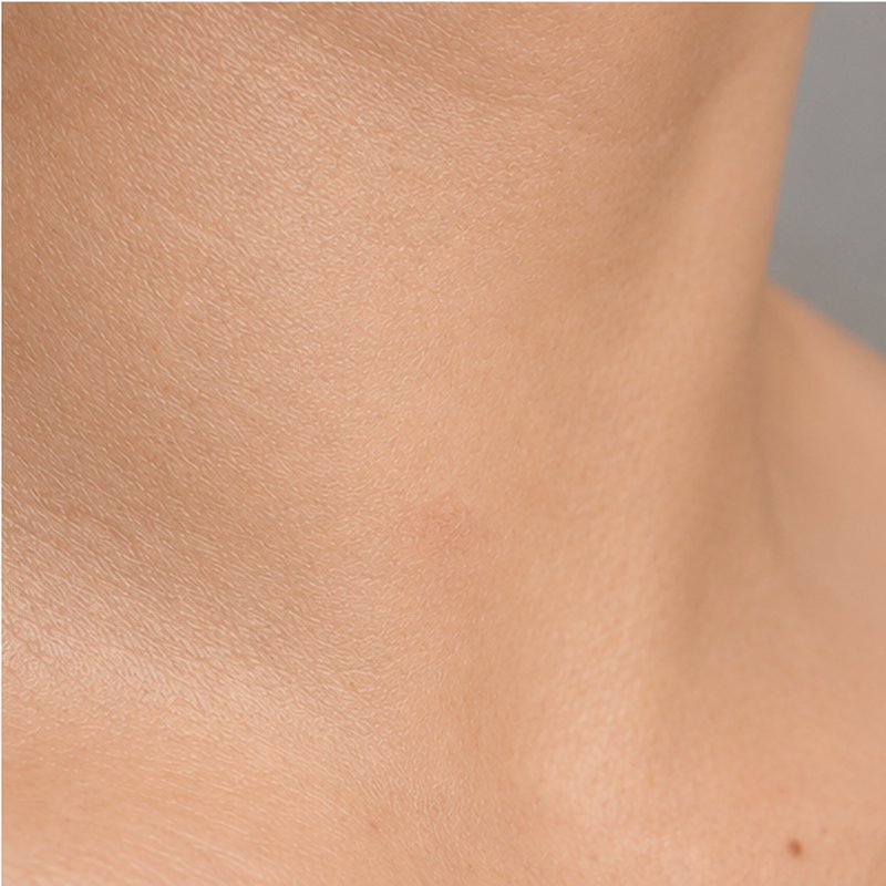 Day 7 smoother-looking skin